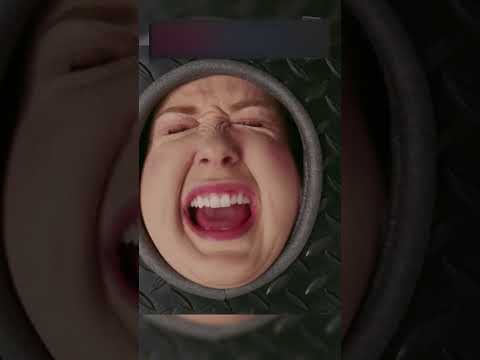 Выкачали весь жир из девушки 😳 #фильм #сериал #кино