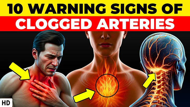 These 10 Warning Signs of Clogged Arteries Could Save Your Life!