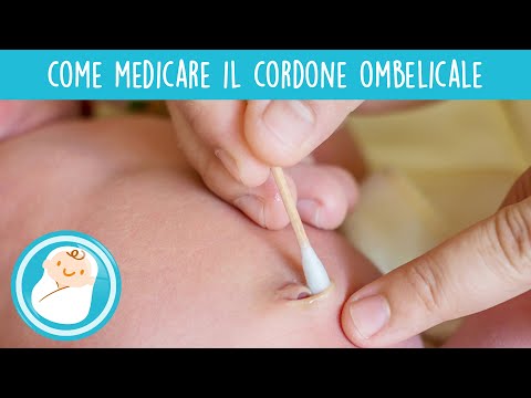 Video: Ombelicale