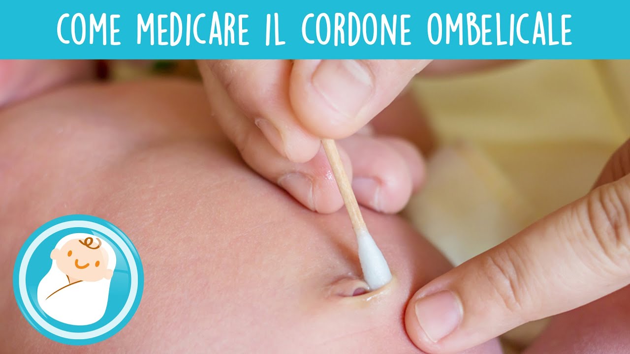 Moncone ombelicale: come medicarlo? 