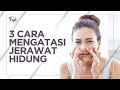 Cara Mengusir Jerawat Nakal di Cuping Hidung