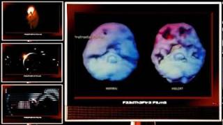 Your Brain - Use It or Lose It (FTF Films)