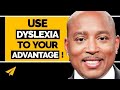 The Dyslexia Advantage - #NoLimits