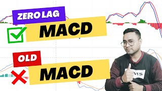 "Zero Lag MACD: The Ultimate Trading Weapon" #macd