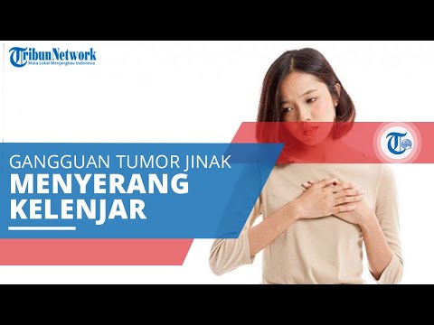 Feokromositoma, Sebuah Tumor Jinak yang Jarang Terjadi dan Menyerang Kelenjar Adrenal