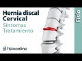 Hernia discal o de disco cervical - Qué es, causas, síntomas y tratamiento