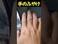 手のふやけ #shorts