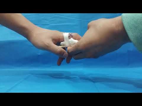 손가락 골절 응급처치방법(Finger Fracture First Aid Method)