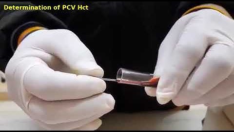 Y1B1:DETERMINATION OF PCV /Hct