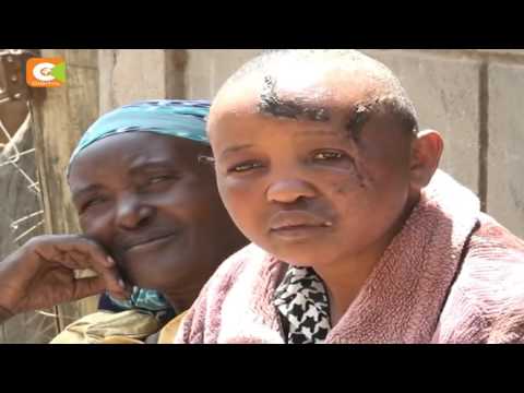 Man arrested after he allegedly chopped off wife’s hands in Machakos