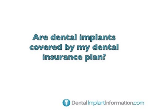 are-dental-implants-covered-by-my-dental-insurance-plan?