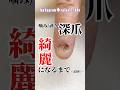 【深爪】綺麗になるまで💅施術解説👄【記録1】噛み癖/剥き癖/コンプレックス【リメイク動画】