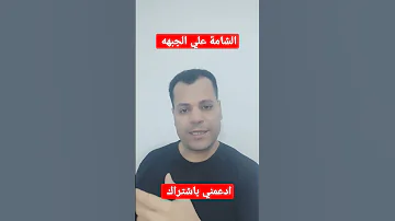 ماذا تدل الشامة تحليل الشخصيات علم النفس 