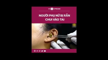 #shorts : Người phụ nữ bị rắn chui vào tai | VnExpress