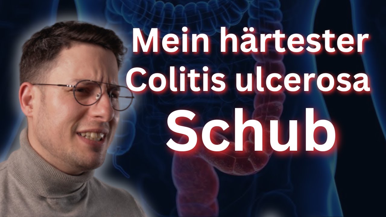 Colitis Ulcerosa Schub Ohne Blut www.youtube.com