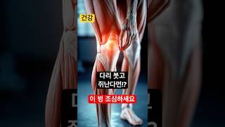 🦵 &quot;다리 붓고 쥐난다면?! 하지정맥류, 이대로 방치하면 큰일 납니다!&quot;