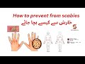 HOW TO PREVENT  SCABIES خارش سے کیسے بچا جائے EASY TO UNDERSTAND