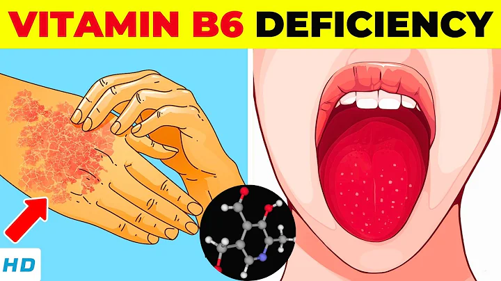 Vitamin B6 Deficiency – Causes, Signs and Symptoms, Best Food Sources & Treatment