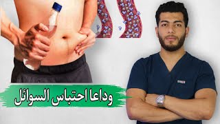 اسرع طريقه لعلاج احتباس السوائل تماما وبدون ادويه |كيفيه التخلص من الماء الزائد في الجسم