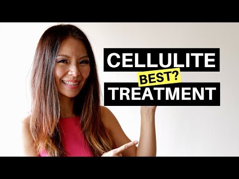Cellulite Treatment Before And After: Venus Legacy Cellulite Treatment