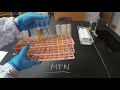 Most probable number mpn  microbiology