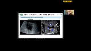 Basic Ultrasound by Dr. Diane Lambo  Consultant Maternal Fetal Medicine (Obstetrics) U.K.