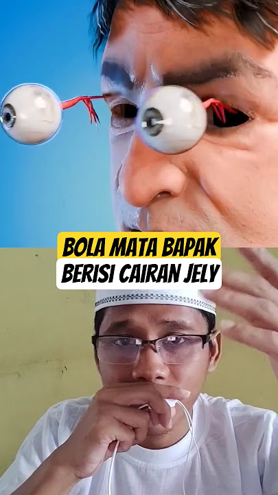Bola mata bapak ini keluar dan di belah 2 #eyes #butifyoucloseyoureyes #science #lens