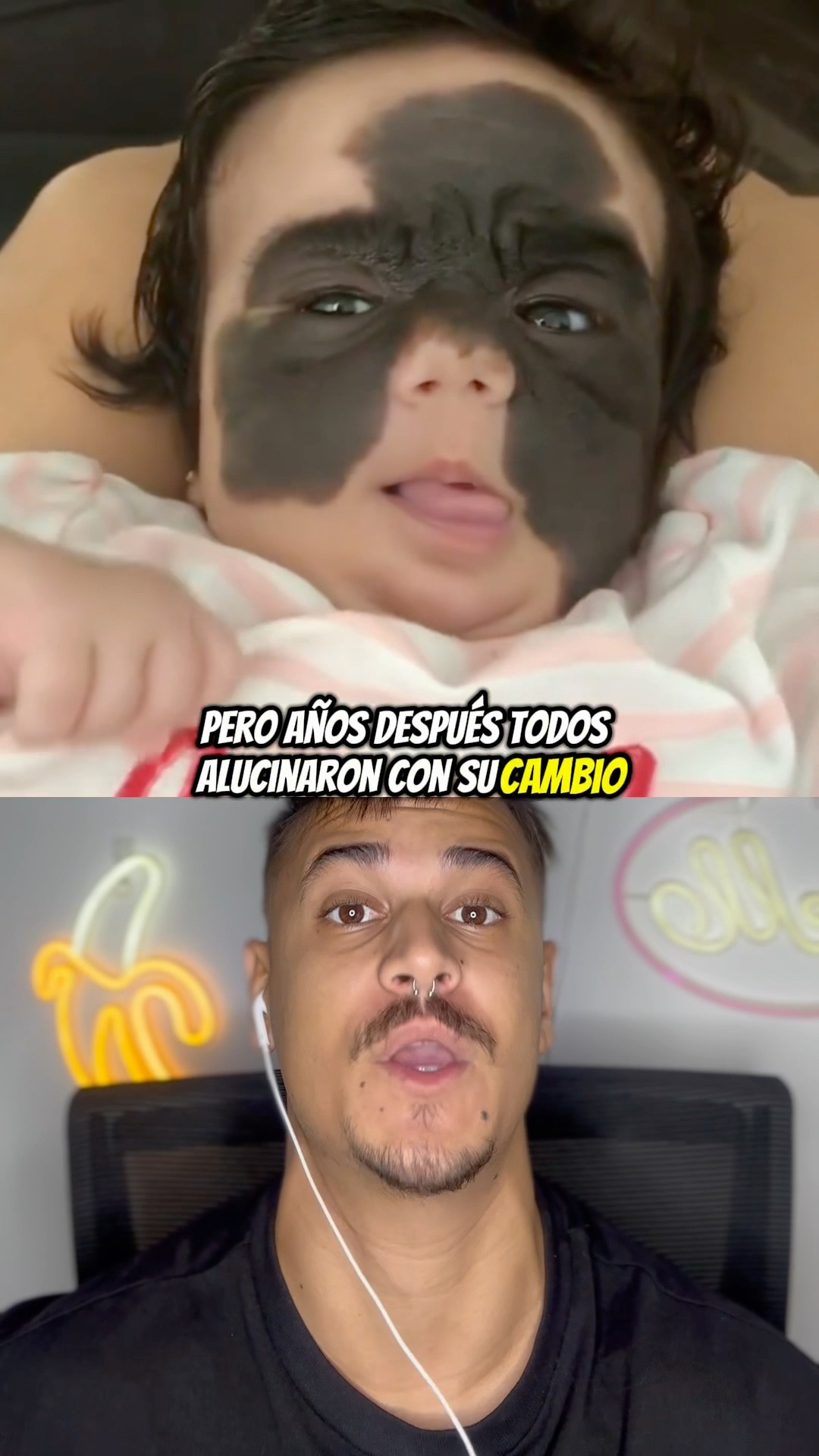 A Esta Niña La Llamaban Monstruo, Años Después Todos Alucinaron Con Su Cambio Parte 2 ? #shorts