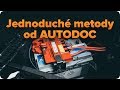 Jak zkontrolovat autobaterii vašeho auta | AUTODOC