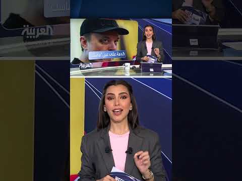 كدمة في عين إيلون ماسك بسبب ابنه