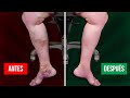 Ejercicios para activar la circulación de las piernas