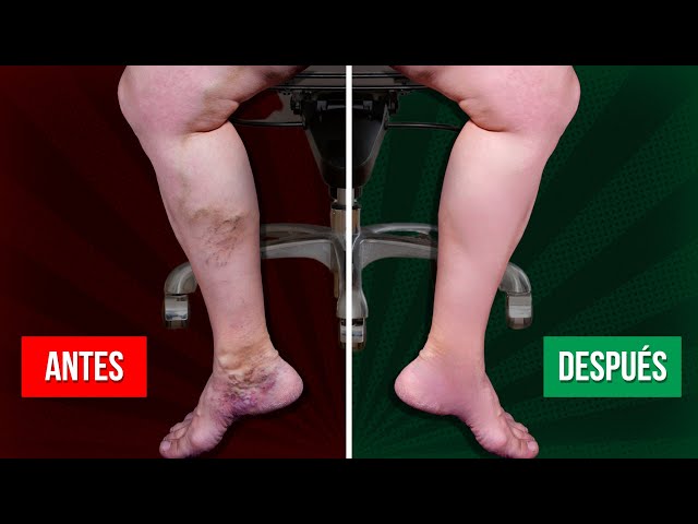 5 Ejercicios para MEJORAR la CIRCULACION de las piernas SENTADO EN EL  TRABAJO 