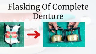 Flasking of Complete Denture