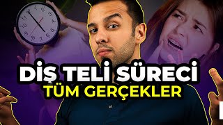 5 Daki̇kada Di̇ş Teli̇ - Diş Teli Nasıl Takılır ? Dr Dt Deniz Ertüz Ortodontist