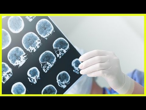 Vidéo: Quelle Est La Différence Entre La Démence Et La Maladie D'Alzheimer?