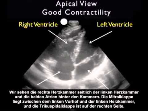 Anleitung: Kardiologische Ultraschalluntersuchung – apikale Darstellung