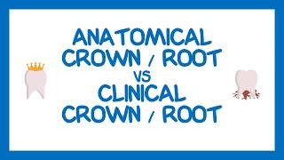 Anatomical Crown and Root vs Clinical Crown and Root