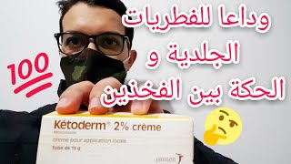 كيفية علاج الفطريات الجلدية بين الفخدين و المناطق الحساسة بكريم كيتودرم ketoderm