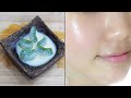 Aloe Vera Gel Treat Very Well On Facial Skin In 7 Days -Aloe Vera For Skin Care