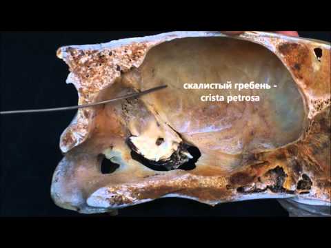Video: Deformita Hrudnej Kosti U Mačiek