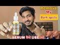 Garnier 30x Vitamin C Serum Review 2026 Dark Spots Glow सच य झ ठ How To Use Vitamin C Serum Garnier 30x Vitamin C Serum Review 2026 Dark Spots Glow सच य झ ठ How To Use Vitamin C Serum