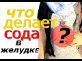 ЧТО ДЕЛАЕТ СОДА В ЖЕЛУДКЕ И ДВЕНАДЦАТИПЕРСТНОЙ КИШКЕ !