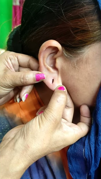 Ear hole repair#Rekhabautysalon