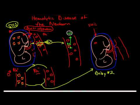 pathophysiology-of-diabetes-mellitus