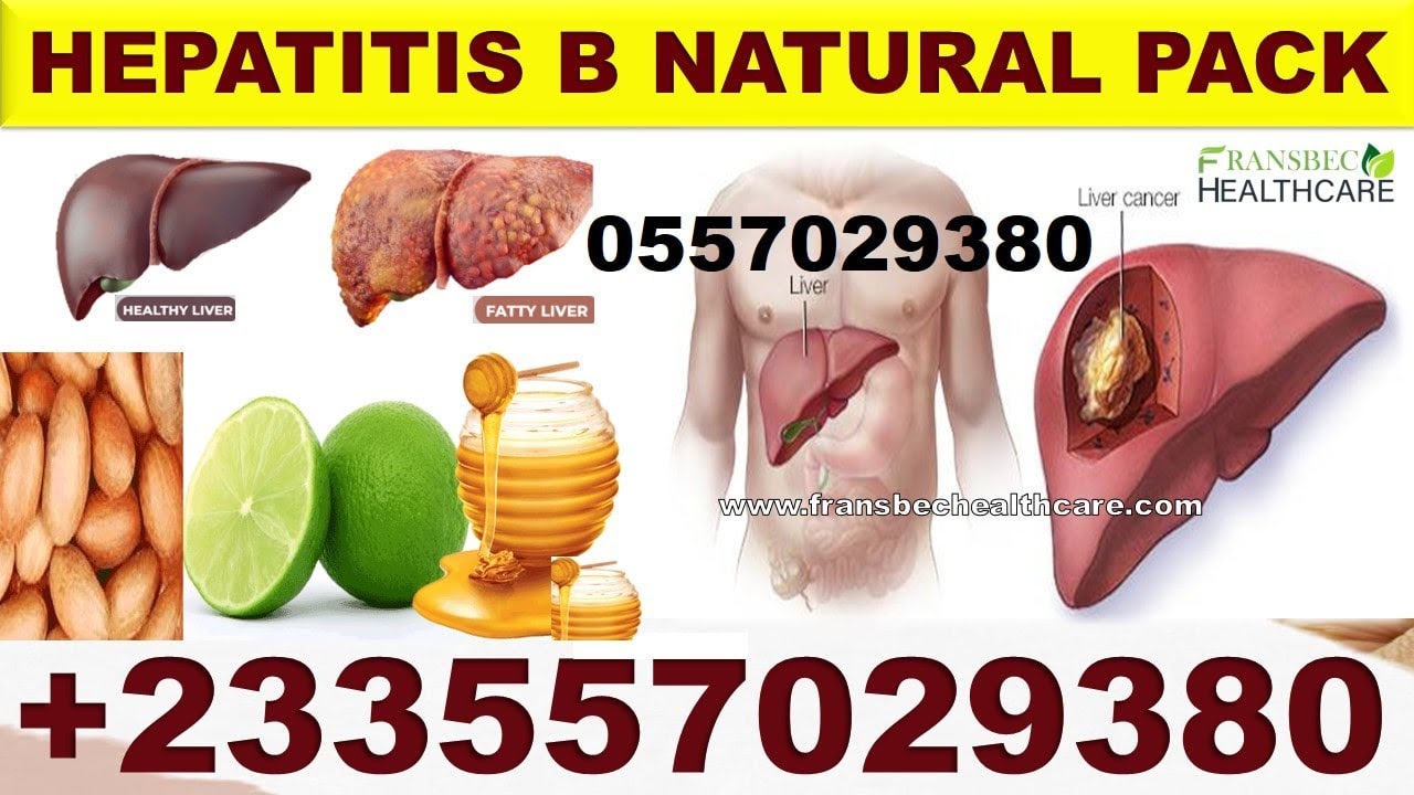 natural-remedy-for-hepatitis-b-cause-and-treatment-of-hepatitis-b