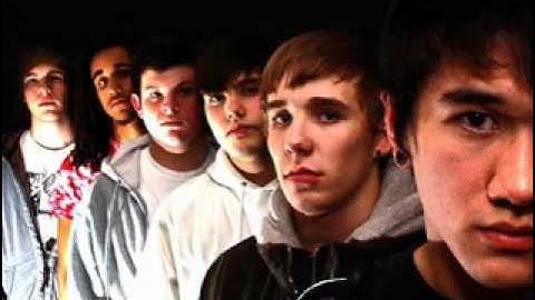 Gamma Pulse- Pacemaker