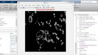Detection of Lung Cancer using Sputum Image Segmentation