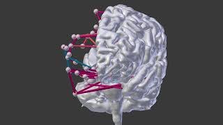 fMRI rest connecitvity