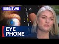 Sydney hospital testing phone gadget to help detect skin cancer risk | 9 News Australia