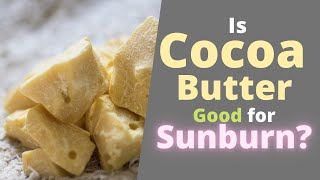 Is Cocoa Butter Good for Sunburn? Does it Help Sunburn to Give Relief?